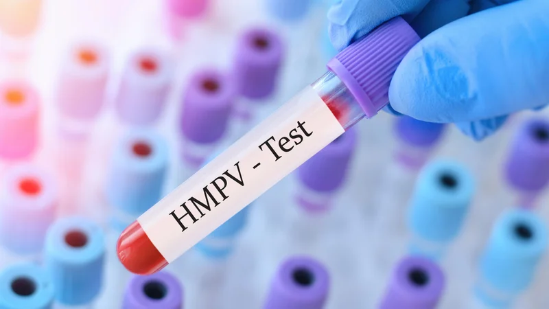 Šta je humani metapneumovirus HMPV i koji su simptomi?