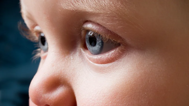 Šta je retinoblastom i koji znaci se vide kod deteta?