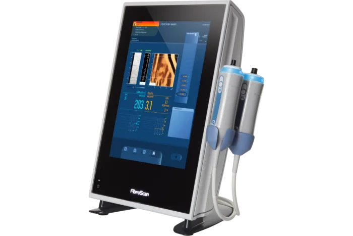 Fibroscan
